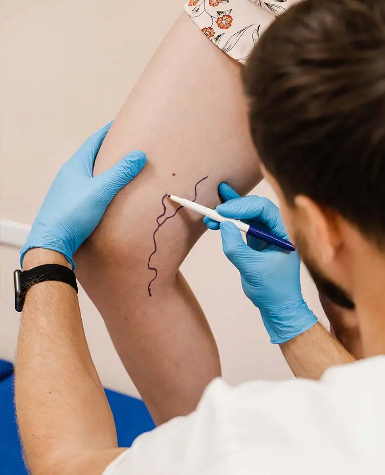 Doktor Kosi Žilna kirurgija